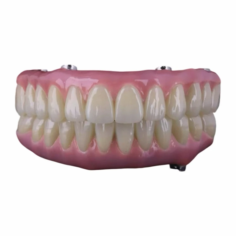 Implant de boca completa de pont Malo híbrid de titani